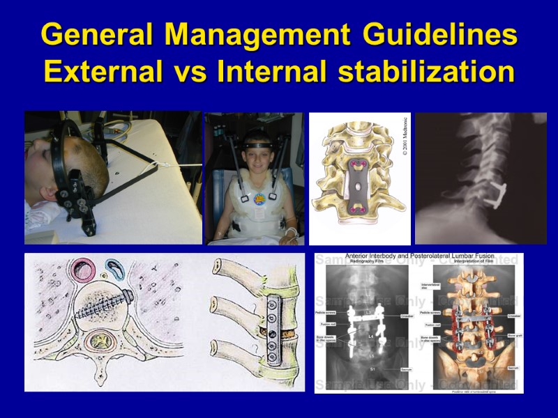 General Management Guidelines External vs Internal stabilization